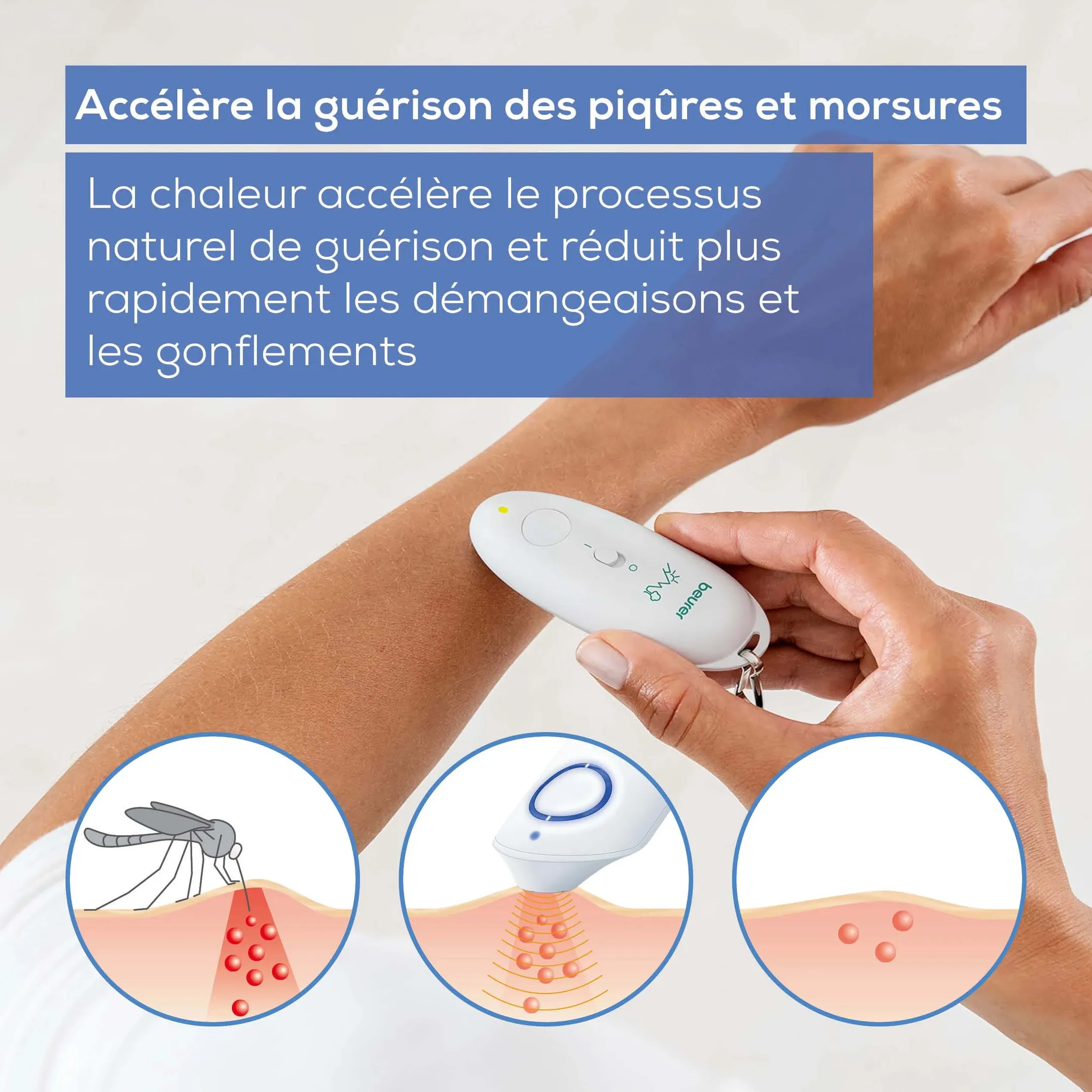 Beurer Appareil soulageant les piqûres d’insectes BR10 image
