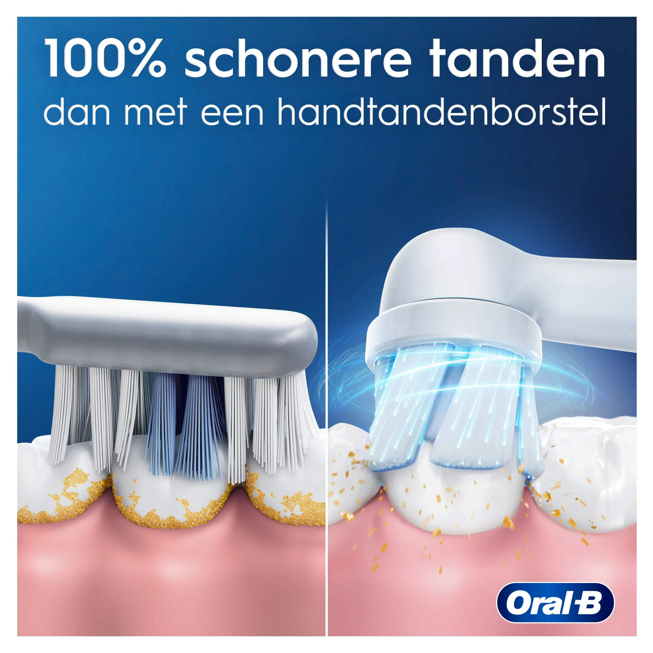 Oral-B Elektrische tandenborstel iO2 zachtroos + reisetui image