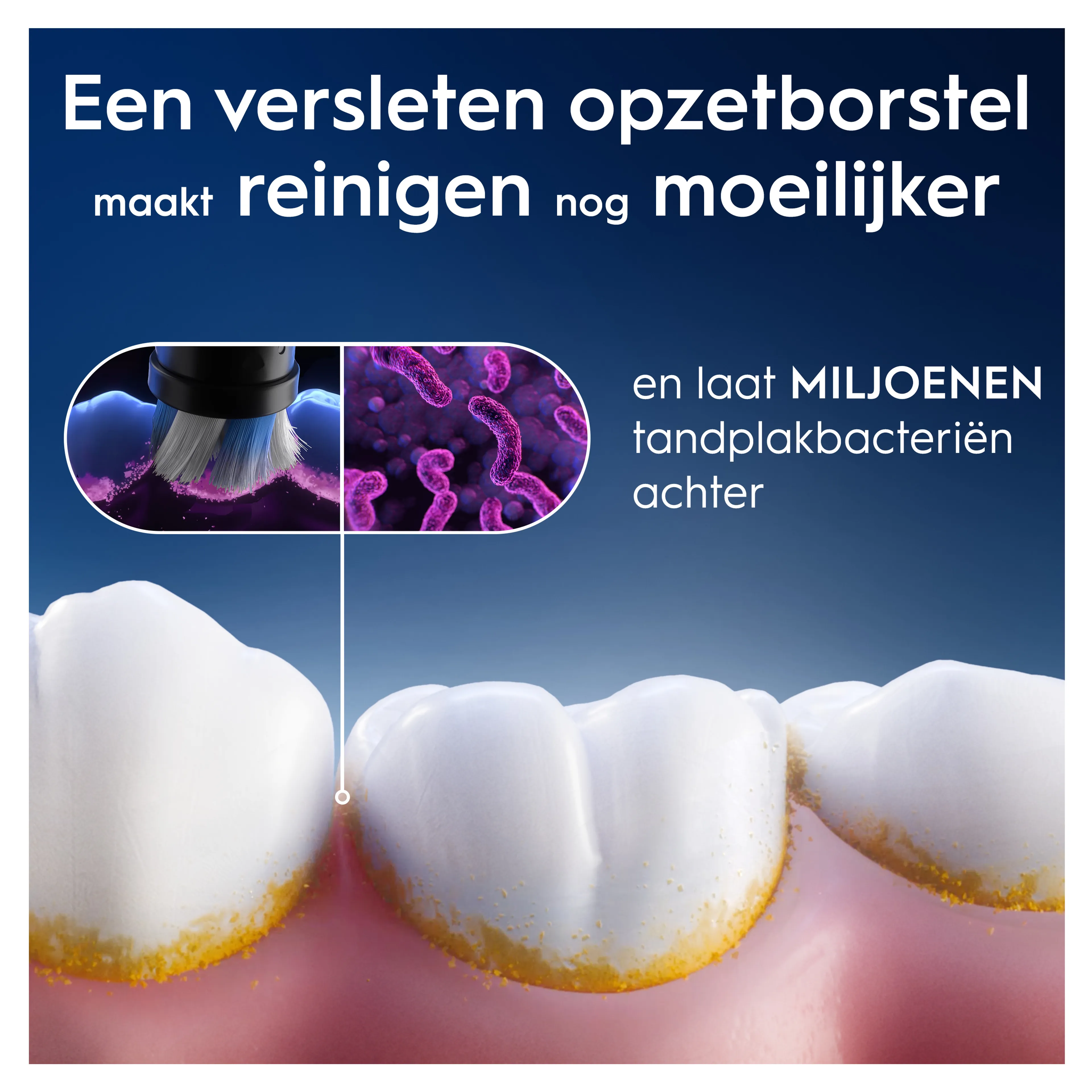 Oral-B Opzetborstel ORAL-B  IO GENTLE CARE wit 4CT image
