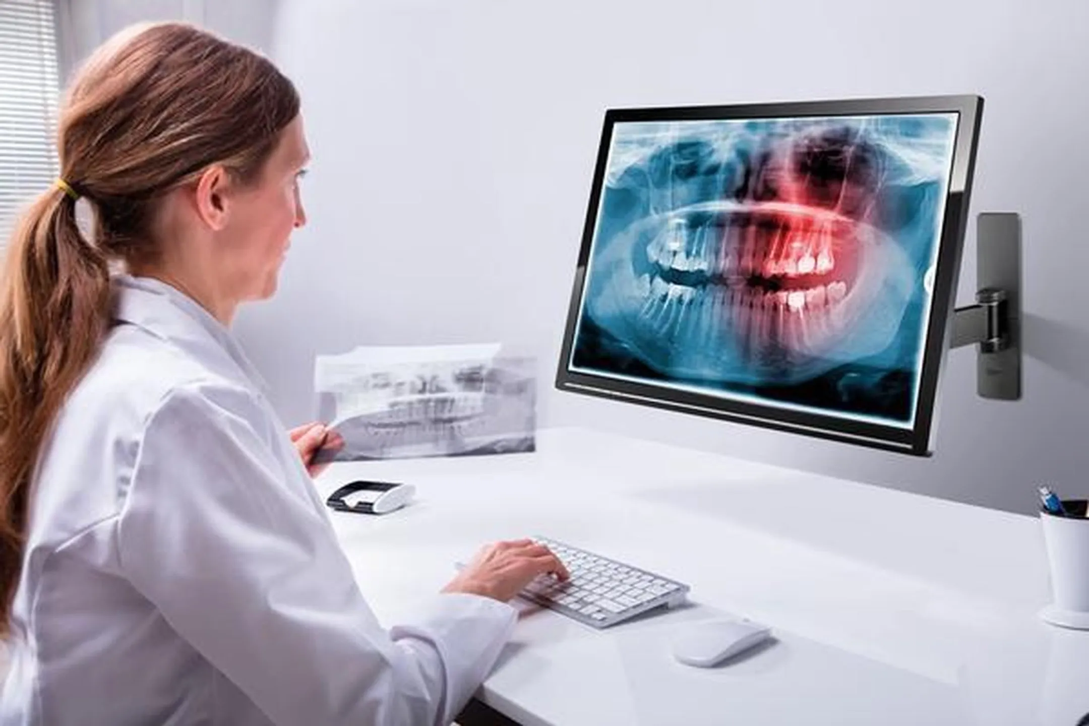 Vogels PFW 1030 Draaibare wandsteun 10,1-27,5 inch - Zwart image