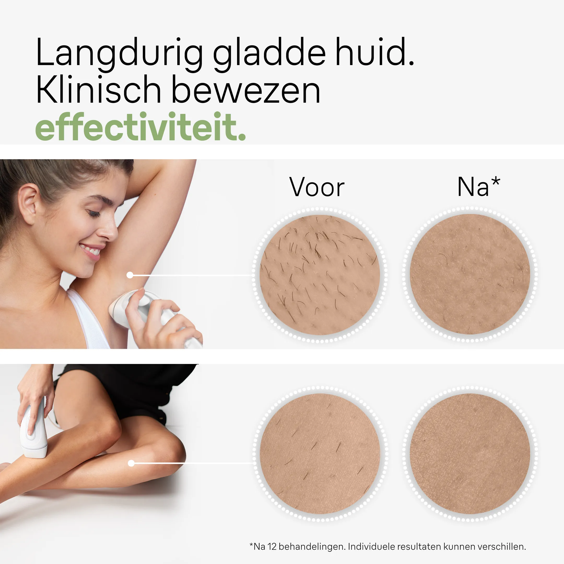 Braun IPL Silk-expert Pro 3, ontharing voor thuis, incl. etui, Venus-scheermesje, 2 koppen, PL3122 image