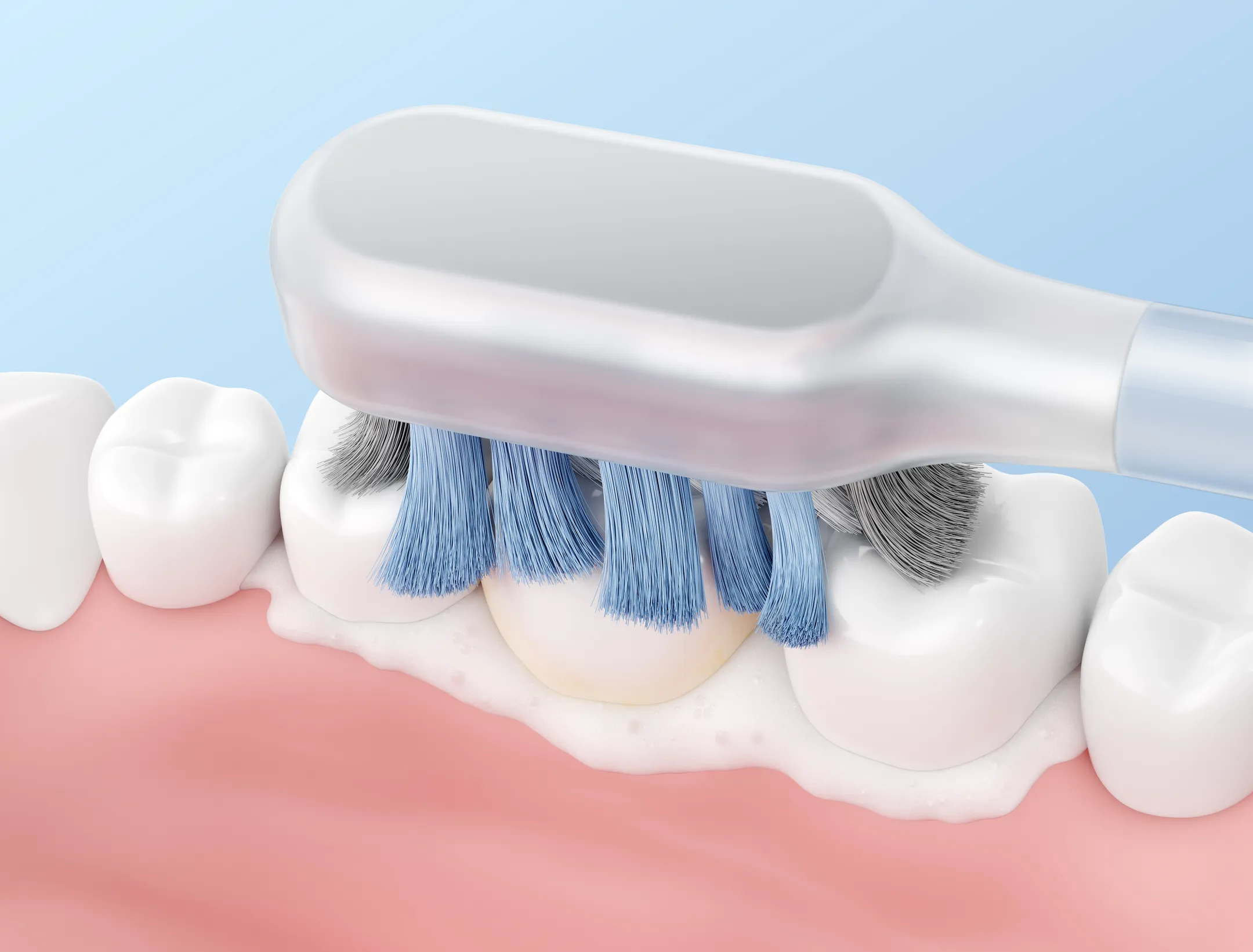 MOVA Brosse à dents électrique Fresh Pro Argenté image