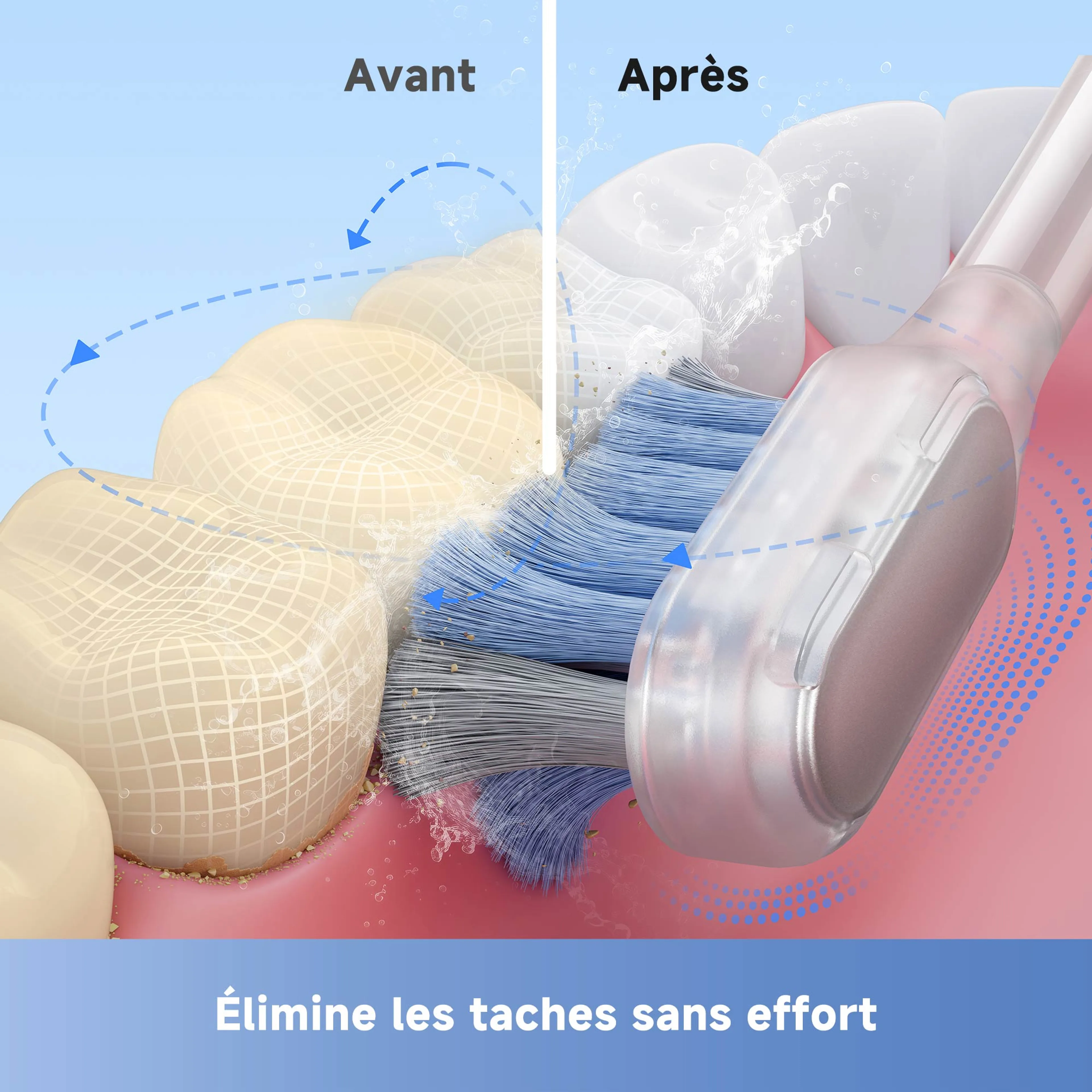 MOVA Brosse à dents électrique Fresh Pro Argenté image