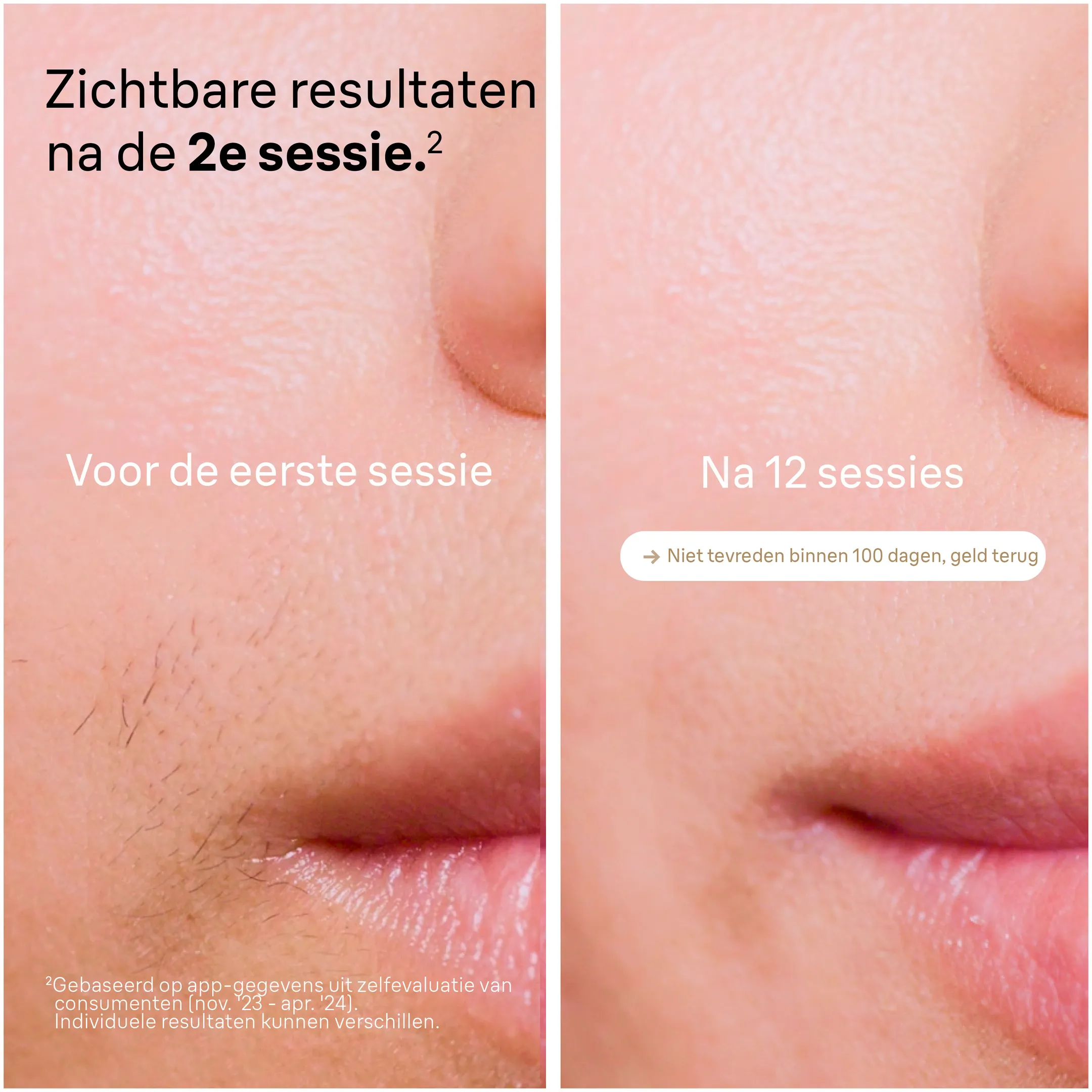 Braun IPL Silk-expert Pro 5, ontharing voor thuis, Etui, Gillette-scheermesje, 1 kop, PL5052 image