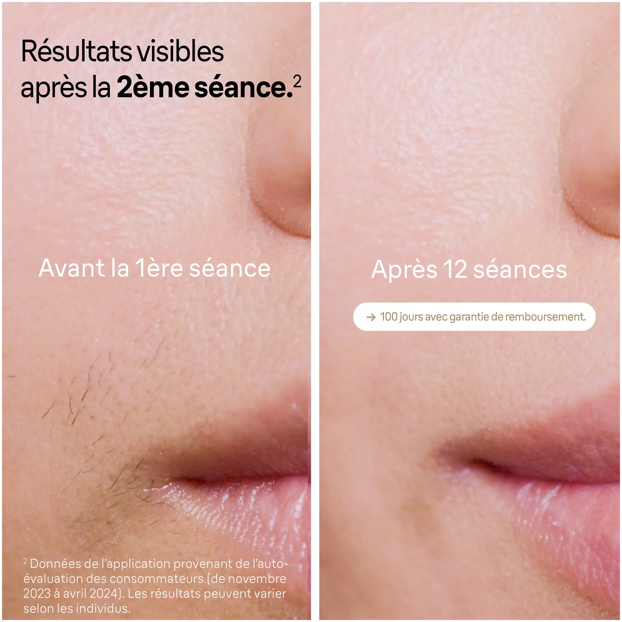 Braun Épilateur À Lumière Pulsée Silk·expert Pro 5, Avec Pochette, Rasoir Gillette, 1 Tête, PL5052 image