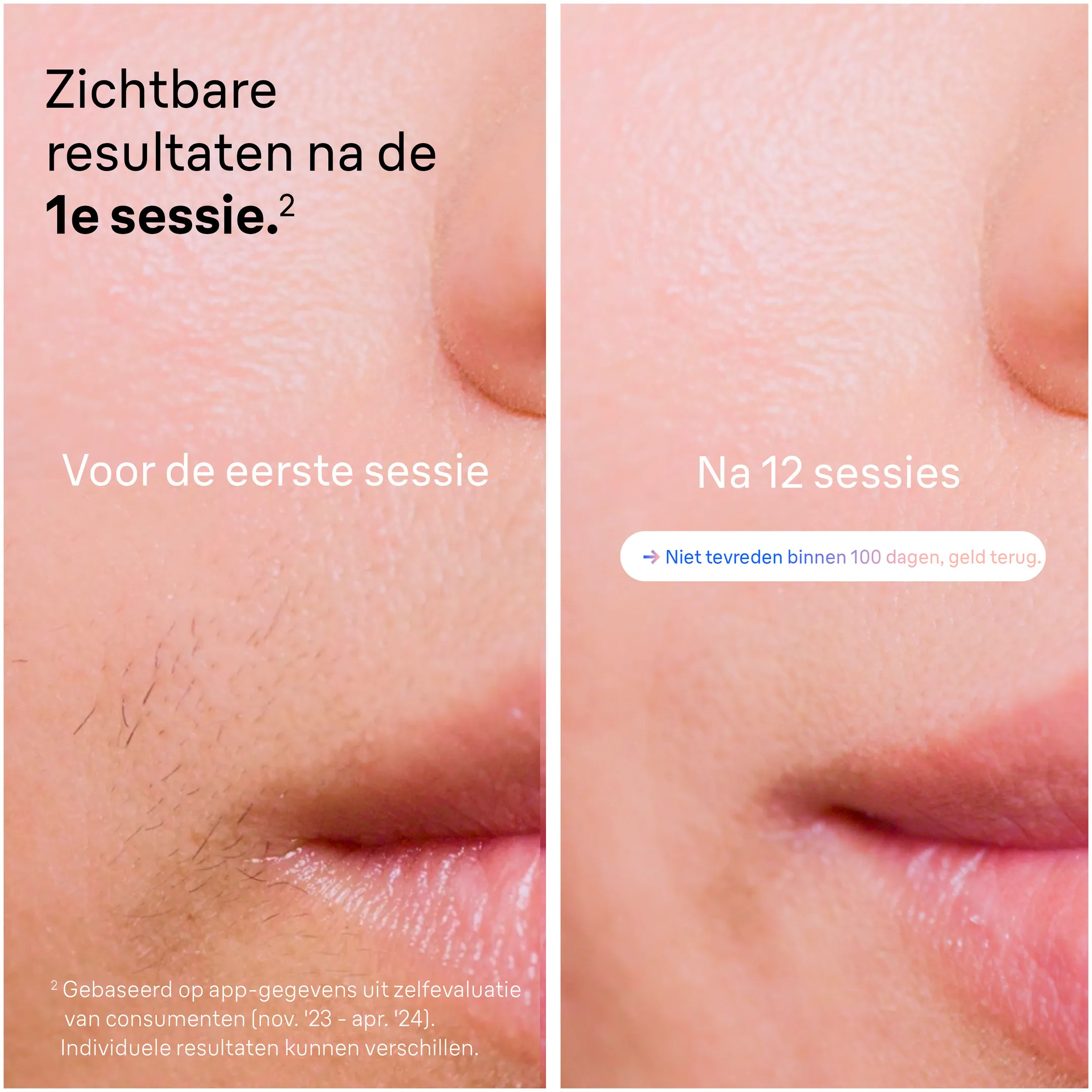 Braun Smart IPL Skin i·expert, Ontharing thuis, Etui, Venus-scheermesje, 2 Koppen, PL7147 image