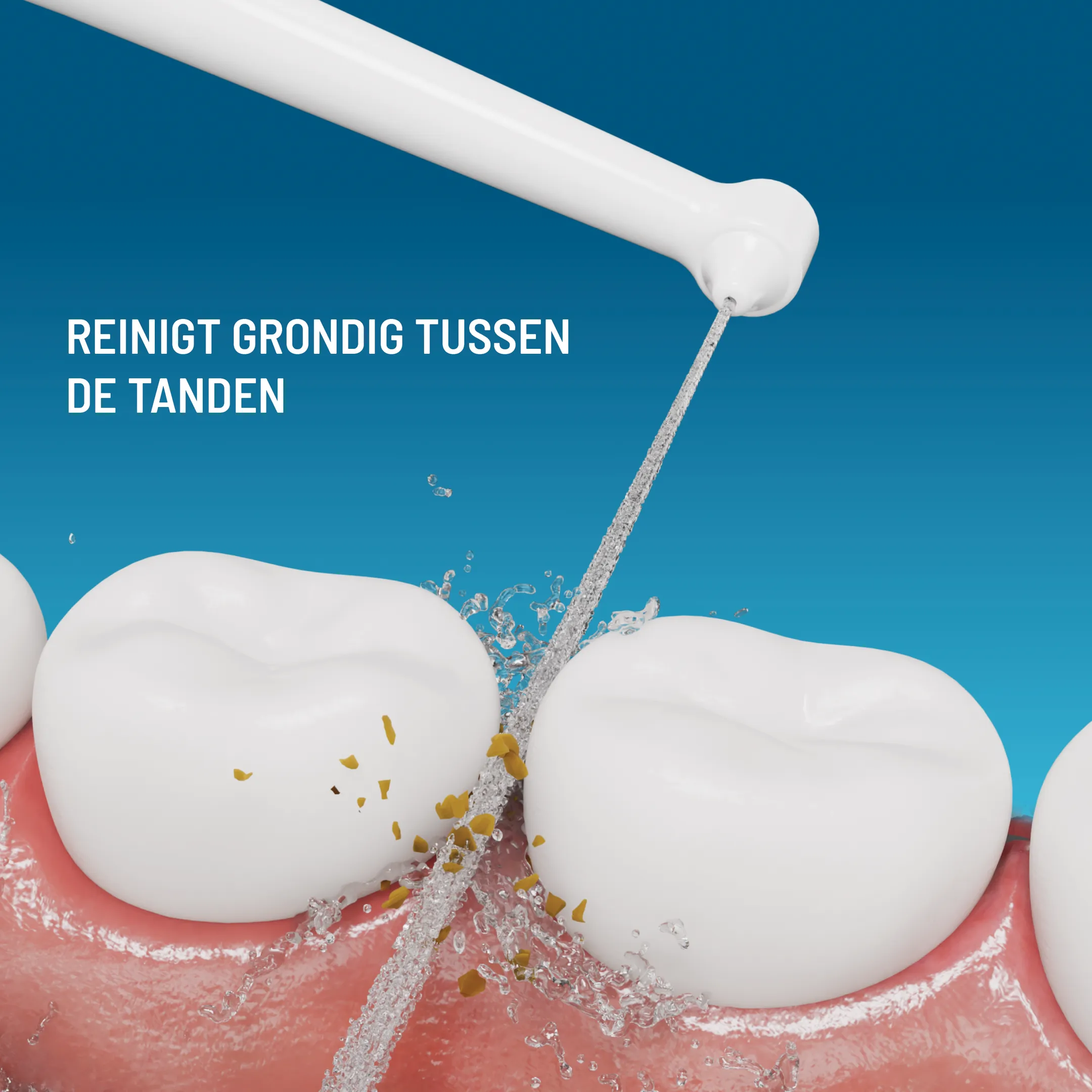 Monddouche opzetstukken - 3st