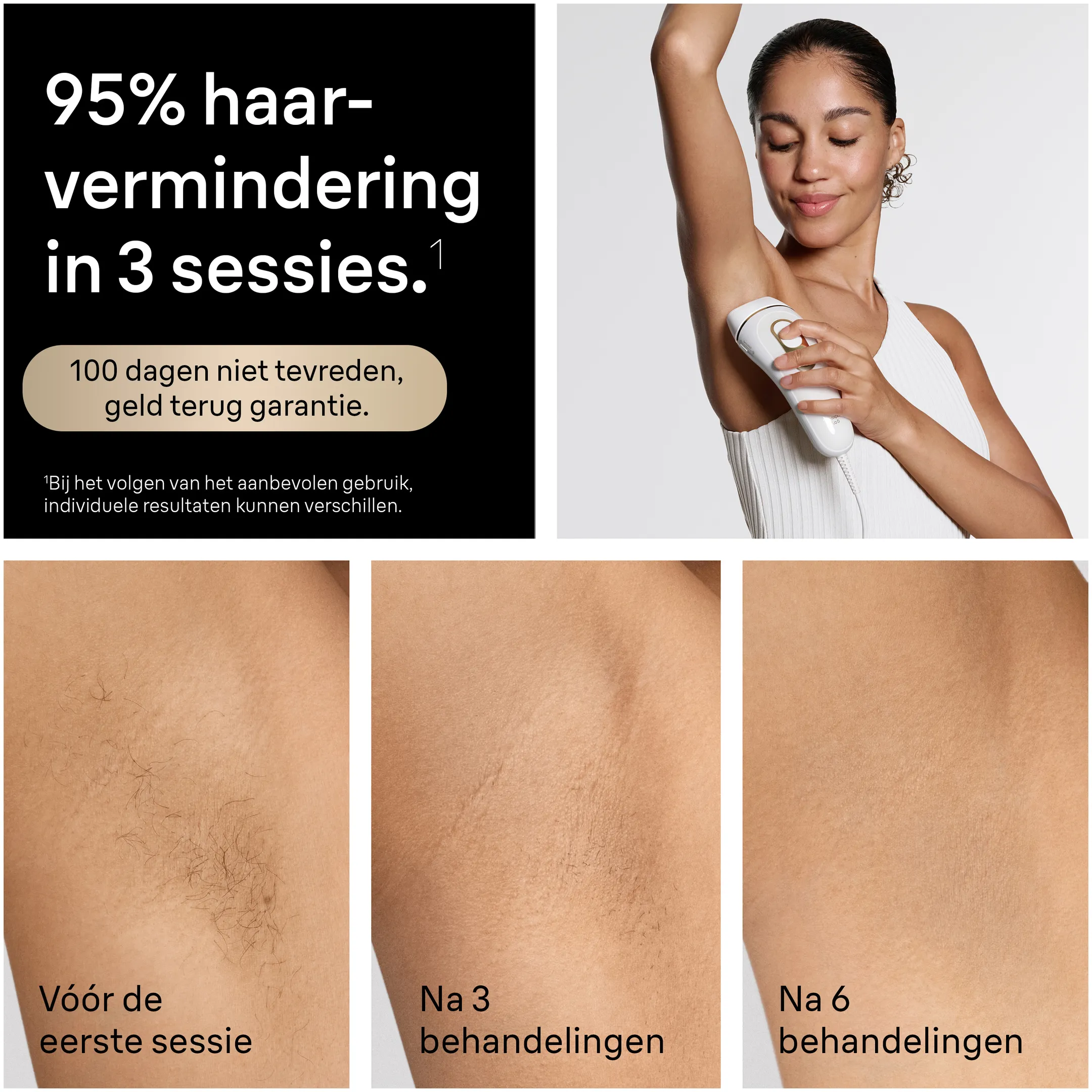 Braun IPL Silk·expert Pro 5, Haarverwijdering Voor Thuis, 4 Opzetstukken, PL5431 image